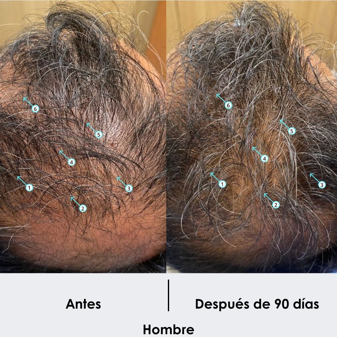Imagen del producto 6